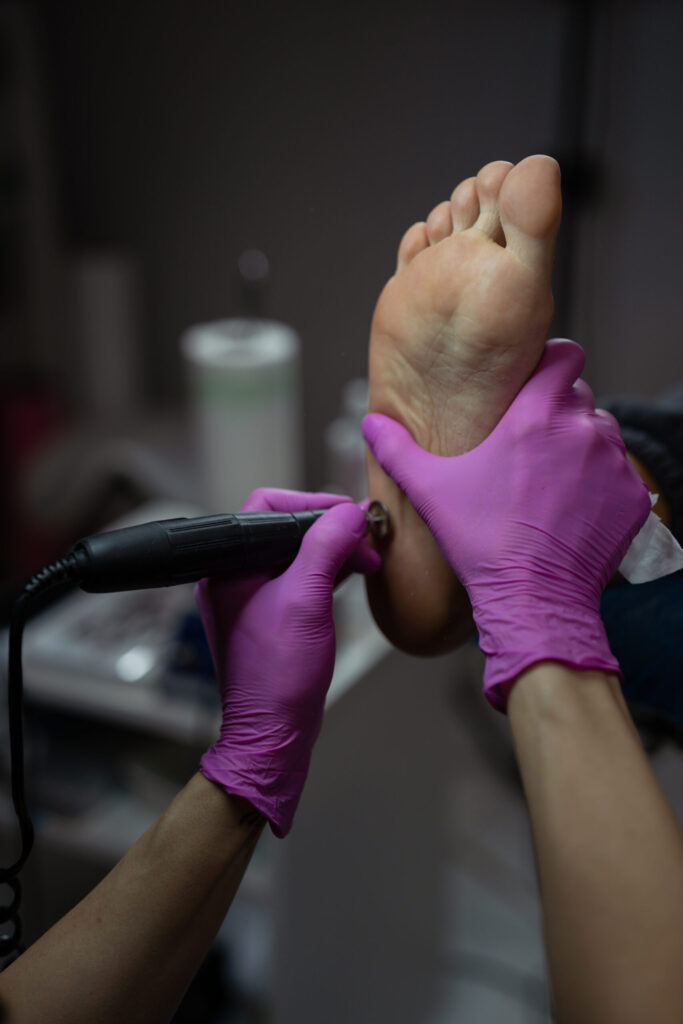 profesjonalny zabieg podologiczny