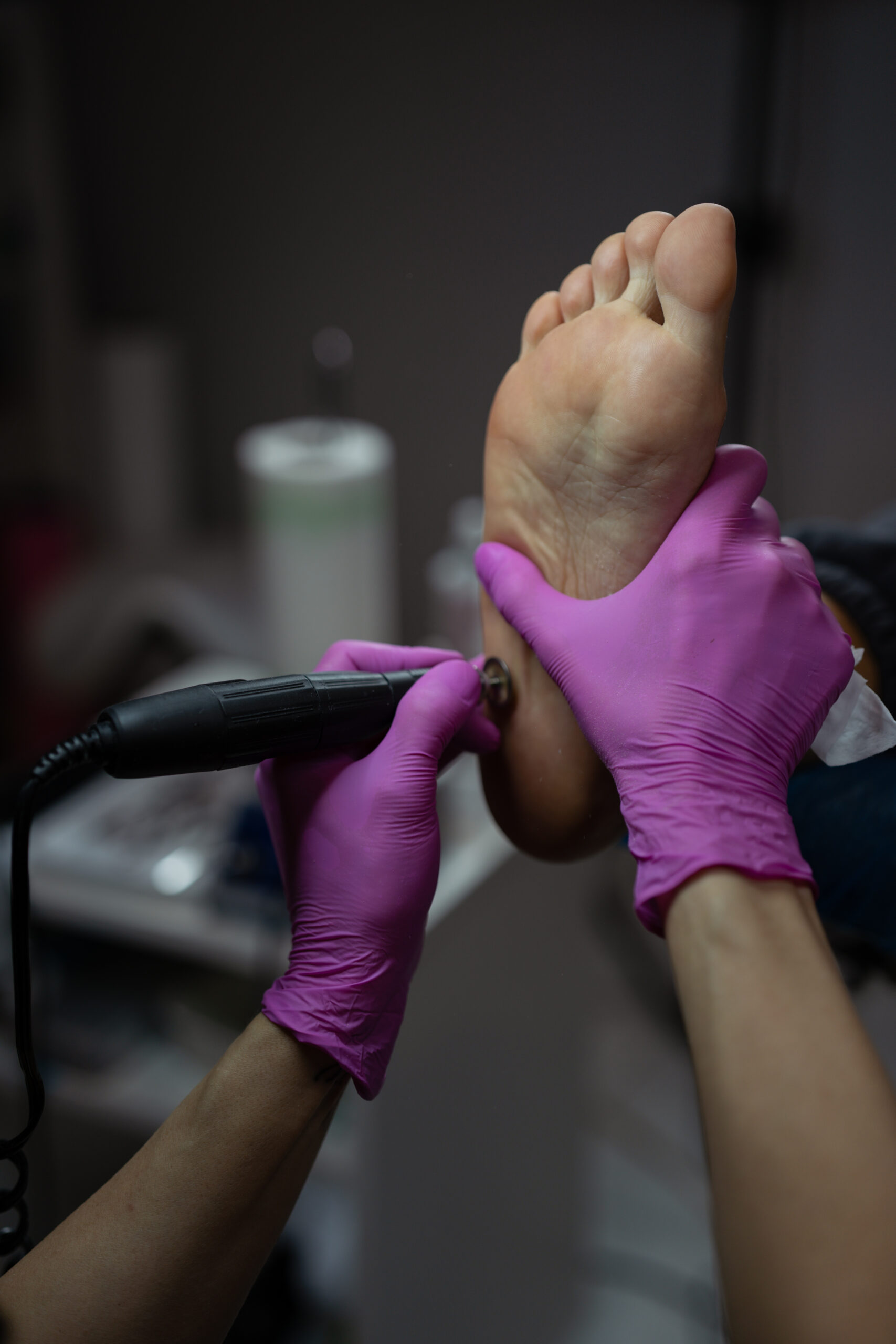 profesjonalny zabieg podologiczny